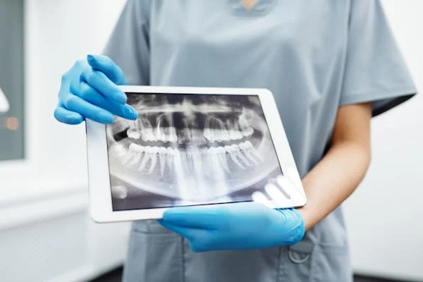 a dentist showing a dental x-ray
