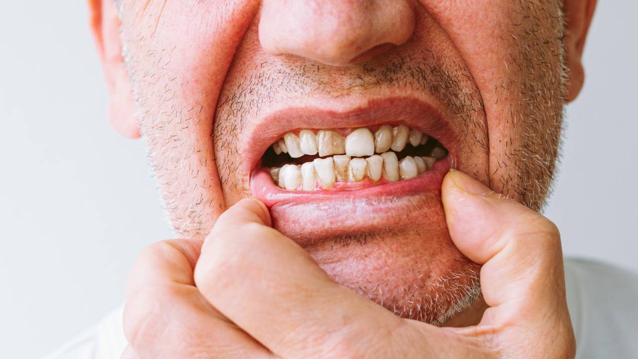 What an Infected Tooth Feels Like Before It Gets Worse