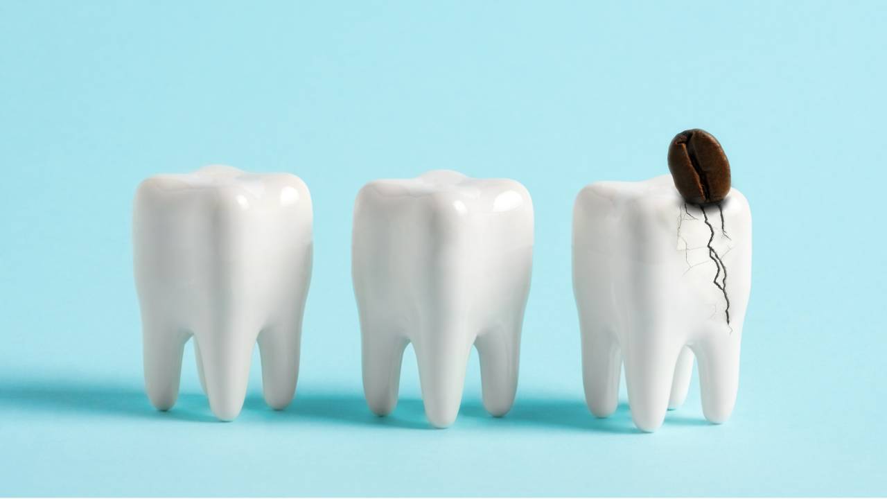 What to Do If a Tooth Cracks Before You Can Get Help